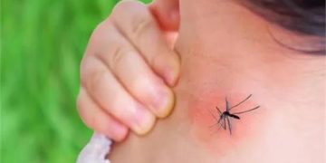 أستاذة علم الفيروسات والمناعة: حمى الضنك قد تسبب الوفاة