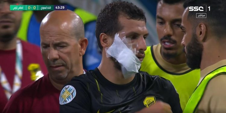 إصابة مرعبة لـ طارق حامد وتم نقله إلى المستشفى |صور