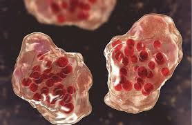 7000إصابة سنويا..عدوى بكتيرية تصيب 58 شخصاً بنيويورك.. ما القصة