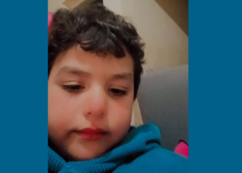 كلب ضال يصيب طفل بجروح بكفر الشيخ ويصيب منطقة أم الشعور بالرعب