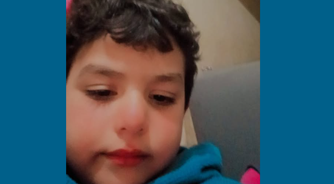 كلب ضال يصيب طفل بجروح بكفر الشيخ ويصيب منطقة أم الشعور بالرعب