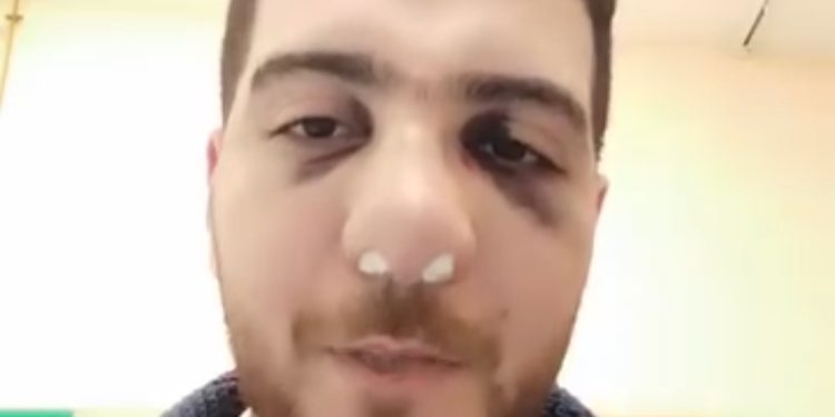 النقابة تكلف مستشارها القانوني لمتابعة واقعة الاعتداء على طبيب المنوفية